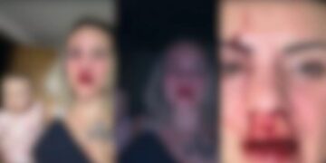 Músico quebra nariz de jornalista que estava com bebê no colo e mesmo assim é solto pela justiça