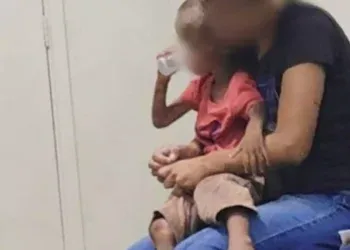 Genitora de menino que foi vítima de maus tratos é presa por tentativa de homicídio; criança está hospitalizada 