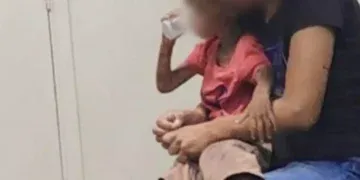 Genitora de menino que foi vítima de maus tratos é presa por tentativa de homicídio; criança está hospitalizada 