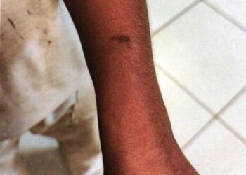 Jovem é preso após espancar a companheira no Jardim Noroeste 