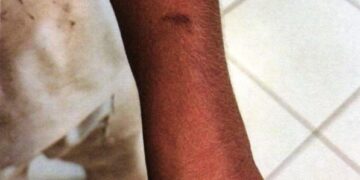 Jovem é preso após espancar a companheira no Jardim Noroeste 