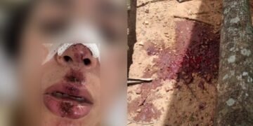 Mulher é agredida por companheiro em conveniência no Jardim Itamaracá