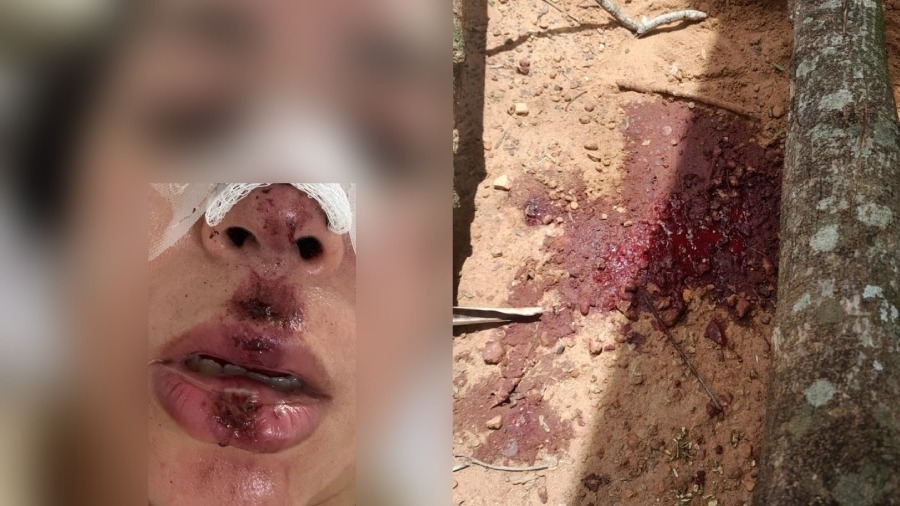 Mulher é agredida por companheiro em conveniência no Jardim Itamaracá