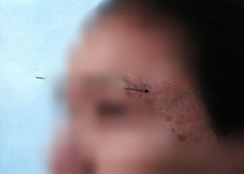 Homem é preso em Campo Grande após agredir esposa por ciúmes