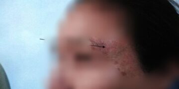 Homem é preso em Campo Grande após agredir esposa por ciúmes