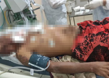 Homem é brutalmente agredido por dívida de R$ 100 em Três Lagoas