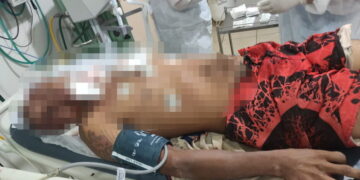 Homem é brutalmente agredido por dívida de R$ 100 em Três Lagoas