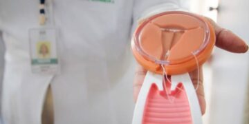 Com mais acesso a métodos contraceptivos de longa duração, MS reduz mortalidade materna em 30%