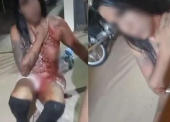Discussão entre travestis termina em briga com facadas na madrugada em Anastácio