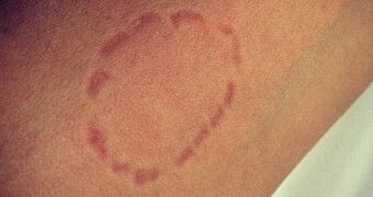 Briga por ciúmes termina com mordidas, faca e confusão em conveniência de Campo Grande