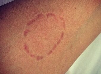 Briga por ciúmes termina com mordidas, faca e confusão em conveniência de Campo Grande