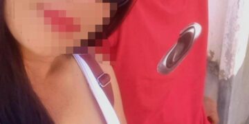 “Prova de amor”: mulher ateia fogo no próprio corpo e está em estado gravíssimo em MS 