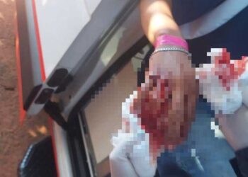 Jovem de 18 anos é esfaqueado em via pública em Aquidauana