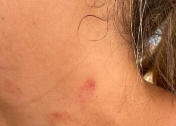 Mulher é agredida pela sobrinha durante aplicação de medicamento em idosa em Bandeirantes