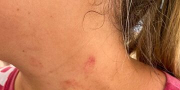 Mulher é agredida pela sobrinha durante aplicação de medicamento em idosa em Bandeirantes