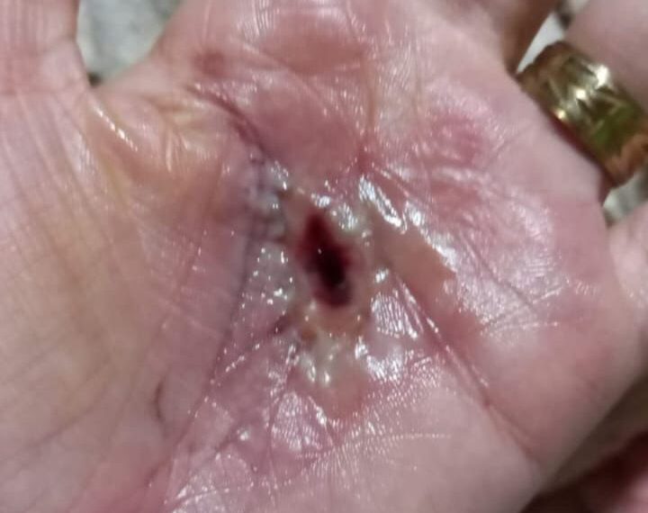 Durante ritual, mulheres são queimadas e ameaçadas por pai de santo em terreiro