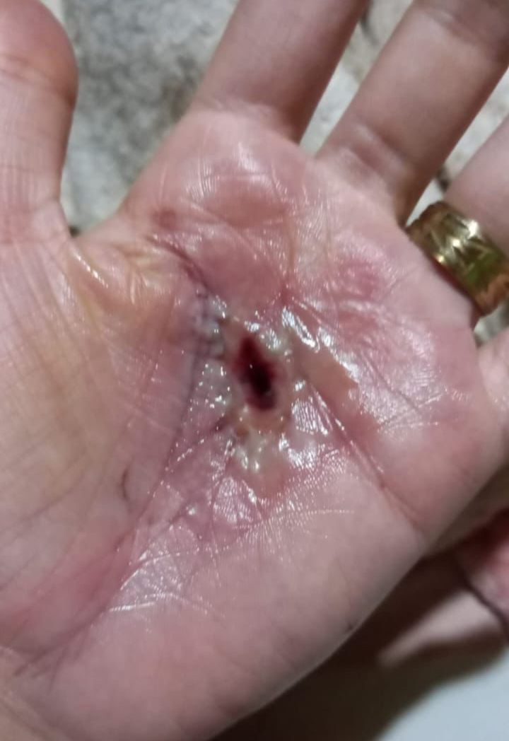 Durante ritual, mulheres são queimadas e ameaçadas por pai de santo em terreiro
