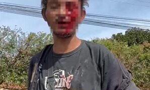 Vídeo mostra homem ensanguentado após ser esfaqueado no olho em Três Lagoas