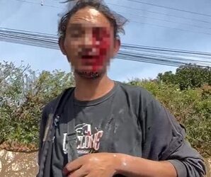 Vídeo mostra homem ensanguentado após ser esfaqueado no olho em Três Lagoas