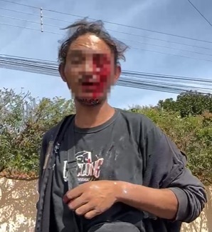 Vídeo mostra homem ensanguentado após ser esfaqueado no olho em Três Lagoas