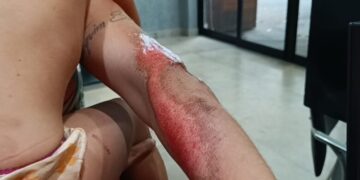 Motorista de aplicativo é liberado após arrastar passageira e criança