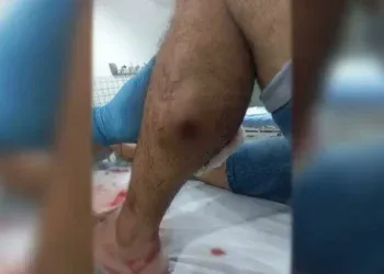 Suspeito de tráfico reage à prisão, entra em luta com policial e é baleado