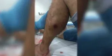 Suspeito de tráfico reage à prisão, entra em luta com policial e é baleado