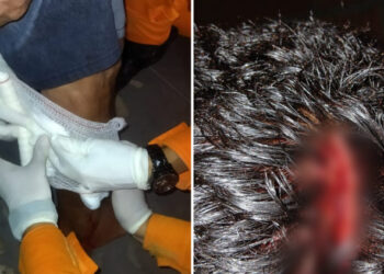 Idoso é atacado por pitbull enquanto caminhava na rua