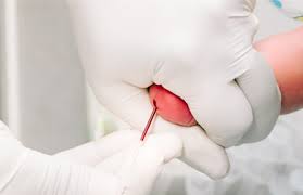 Teste do pezinho ampliado passa a ser oferecido gratuitamente pelo SUS em MS Teste do pezinho ampliado passa a ser oferecido gratuitamente pelo SUS em MS