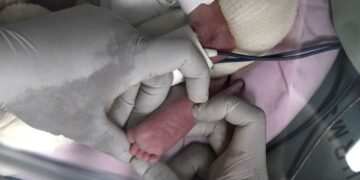 Mato Grosso do Sul amplia acesso à vacina hexa-acelular para prematuros e filhos de mães com HIV