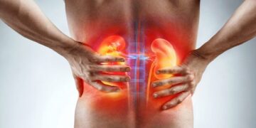 Saúde dos rins: ação gratuita oferece exames e orientação em Campo Grande