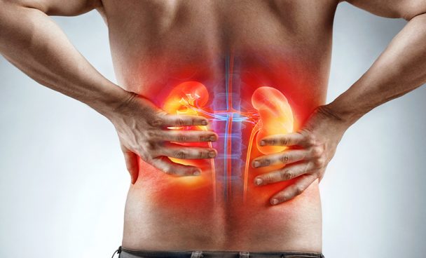 Saúde dos rins: ação gratuita oferece exames e orientação em Campo Grande