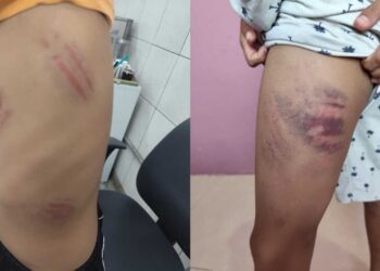 Família do mal: pais de adolescente que agrediu colega autista cercaram menino e também bateram nele