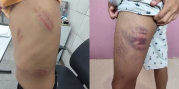 Família do mal: pais de adolescente que agrediu colega autista cercaram menino e também bateram nele