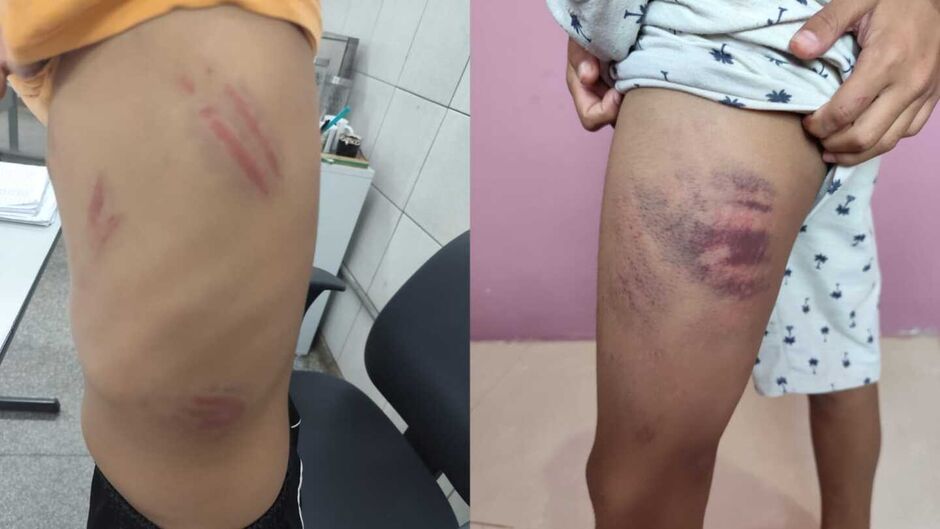 Família do mal: pais de adolescente que agrediu colega autista cercaram menino e também bateram nele