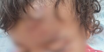 Bebê é atropelada por “amigo do pai”, é liberada da Santa Casa e morre na Capital