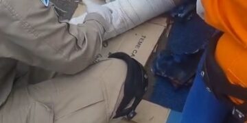 Mulher fica gravemente ferida após ser atropelada na faixa por motociclista