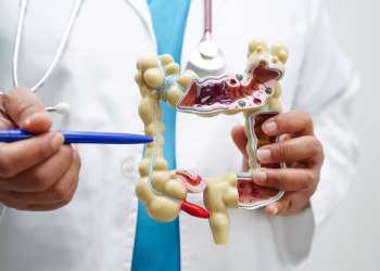 Ação gratuita orienta sobre câncer de intestino neste fim de semana em Campo Grande Ação gratuita orienta sobre câncer de intestino neste fim de semana em Campo Grande