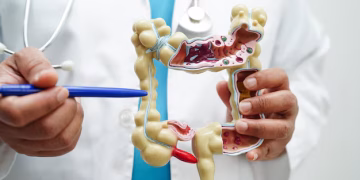Ação gratuita orienta sobre câncer de intestino neste fim de semana em Campo Grande