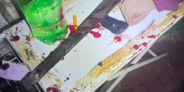 Idoso é atacado a golpes de facão pelo cunhado e sobrevive por pouco em MS