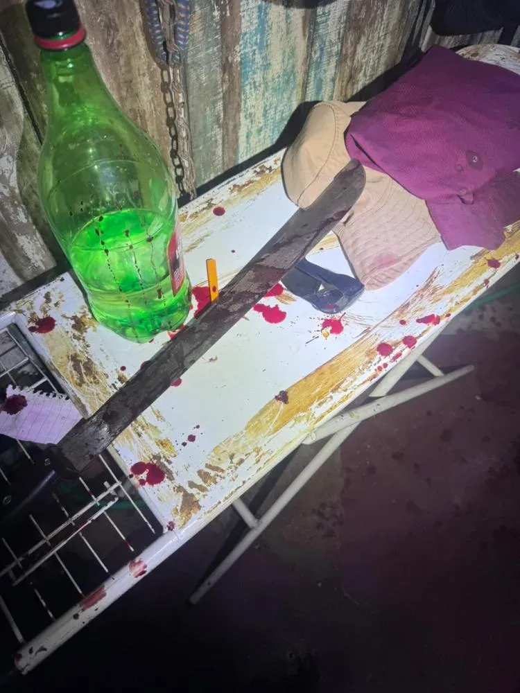 Idoso é atacado a golpes de facão pelo cunhado e sobrevive por pouco em MS