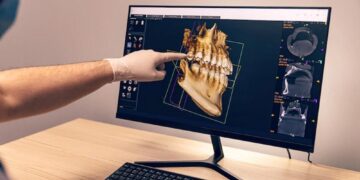 Menos dor: implante em cerâmica e cirurgia sem cortes é opção em clínica da Capital