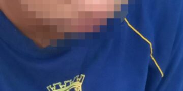 Criança ferida em escola: família busca respostas sobre possível acidente com serpentina