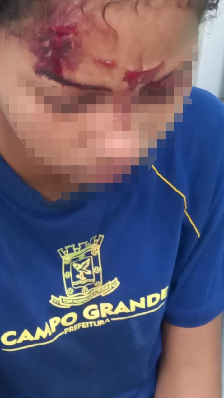 Criança ferida em escola: família busca respostas sobre possível acidente com serpentina