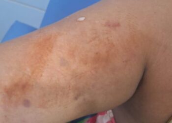 Escapou da morte: mulher é esfaqueada pelo namorado e grita por socorro Escapou da morte: mulher é esfaqueada pelo namorado e grita por socorro