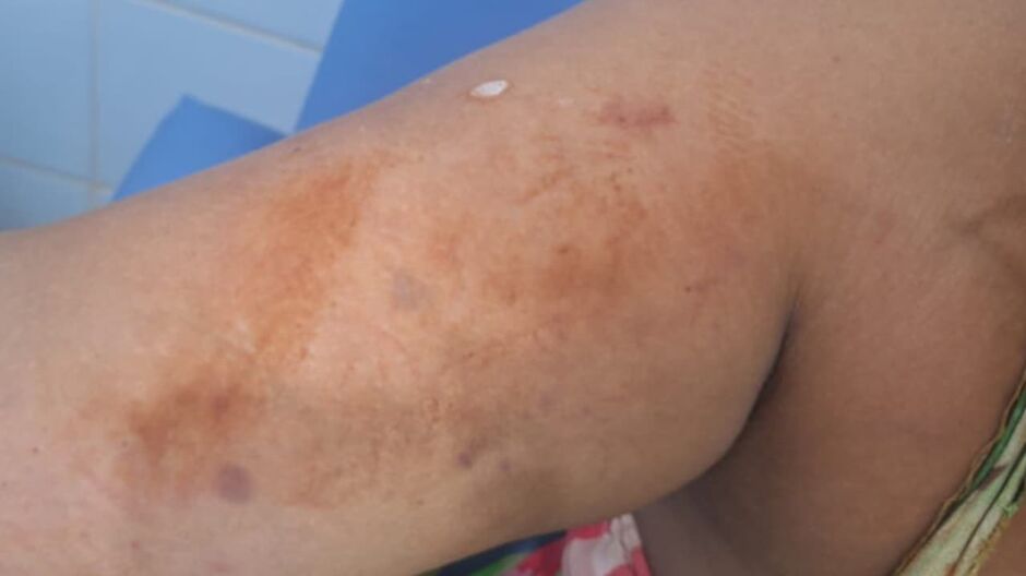 Escapou da morte: mulher é esfaqueada pelo namorado e grita por socorro