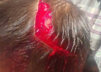 Menino de 2 anos é encontrado com ferimentos graves na cabeça e mãe acaba presa