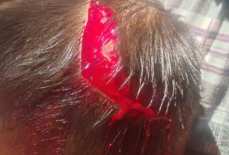 Menino de 2 anos é encontrado com ferimentos na cabeça e mãe acaba presa