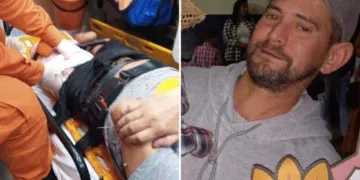 Após ter perna amputada em acidente, motociclista não resiste e morre