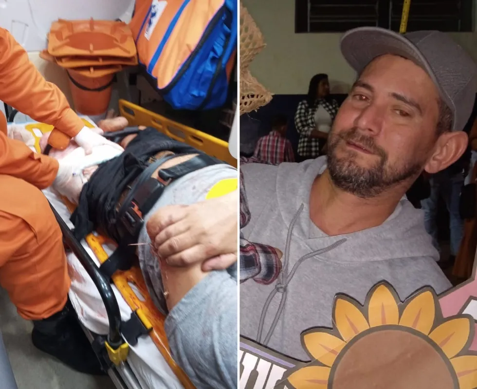 Após ter perna amputada em acidente, motociclista não resiste e morre